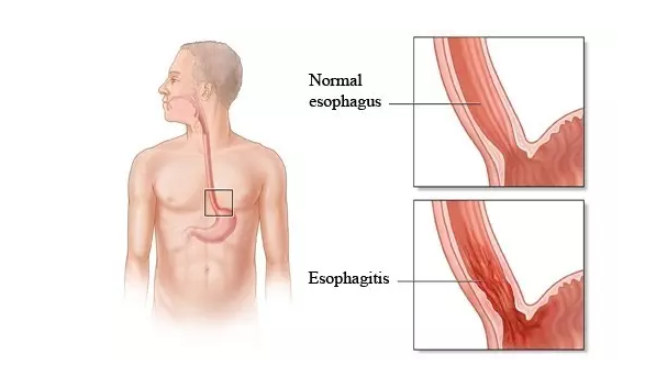 ����÷��MGM(�й���)��������