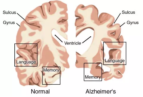 ����÷��MGM(�й���)��������