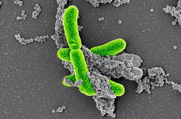 30����ѧ���ҵ���Ѫ֢�о���ģ��