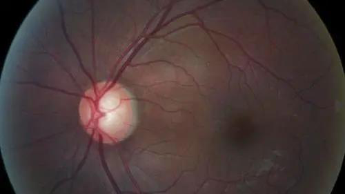 ����۵Ŀ�����Ϯ��������������Զ�������ġ�������