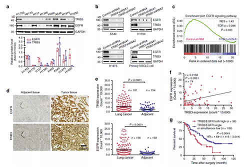 ��ָ����NSCLCϸ��ϵ�ж�TRIB3��EGFR���������ӡ������