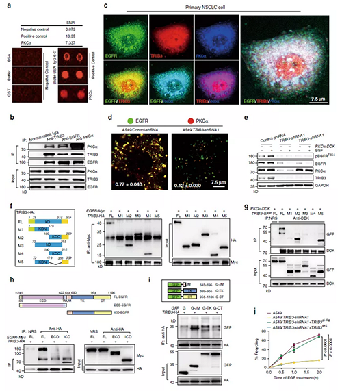 TRIB3��EGFR�໥����������PKC���鵼��EGFR���ữ