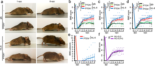 Hyper-IL-6������Ч�ָ�(ȪԴ��Nature)