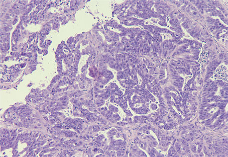 PDX Model (MED-PDX-001C H&E (10X)) PDX Model (MED-PDX-001C H&E (10X))