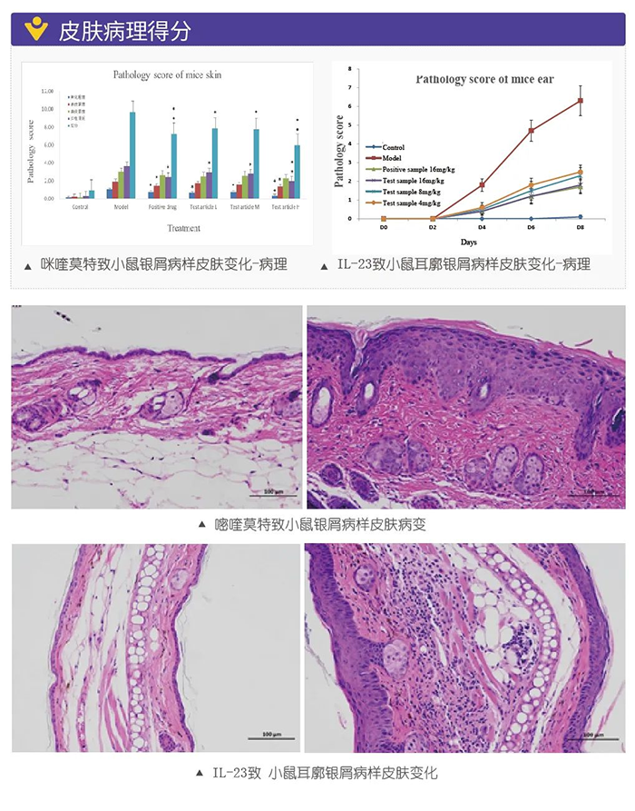 ÃÀ¸ß÷ģÄâÒøÐ¼²¡µÄ½¨Ä£Ä£×Ó-Ƥ·ô²¡ÀíµÃ·Ö.png ÃÀ¸ß÷ģÄâÒøÐ¼²¡µÄ½¨Ä£Ä£×Ó-Ƥ·ô²¡ÀíµÃ·Ö.png