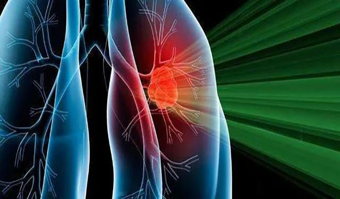 ʢ��̩��1������ҩ��CGT-9475ʵ������˫��˫�� | ����÷һվʽ�ٴ�������ҽҩ�з�Ч��ƽ̨����