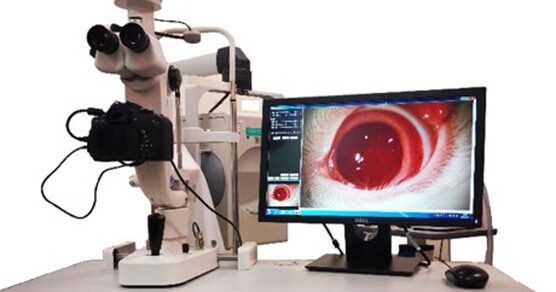 ������϶�ƣ�YZ5T��϶����΢����