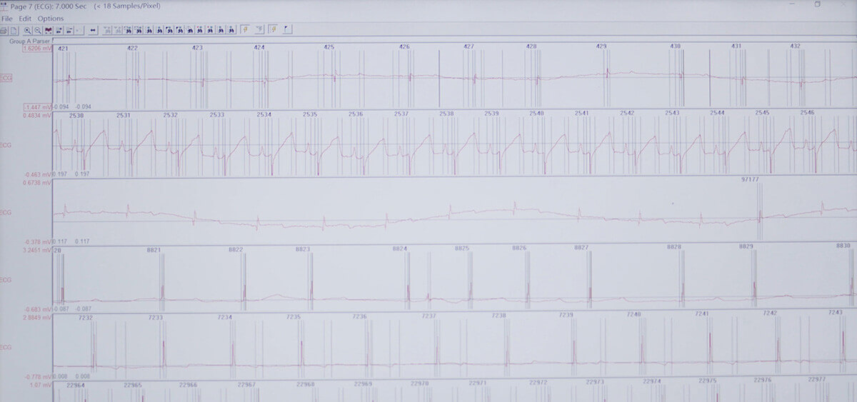 ����÷ SEND ����ת��ƽ̨