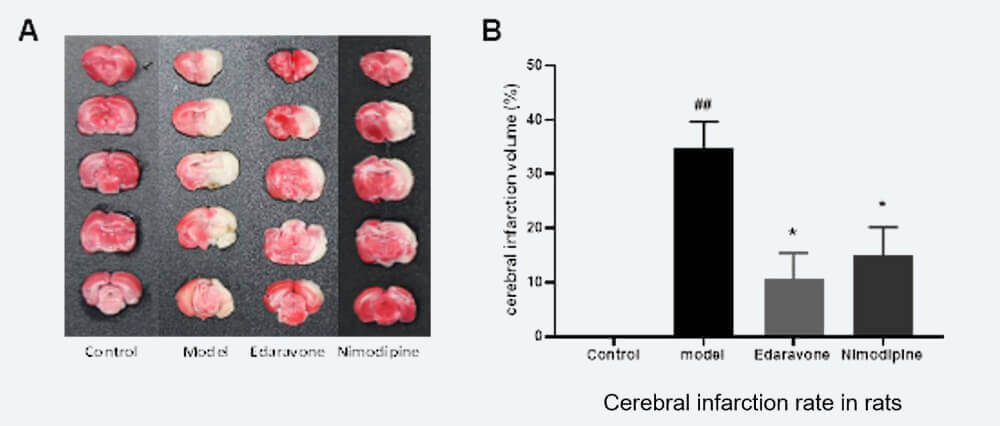 �Թ���������죨 TTCȾɫ�͹�������ȣ�.jpg