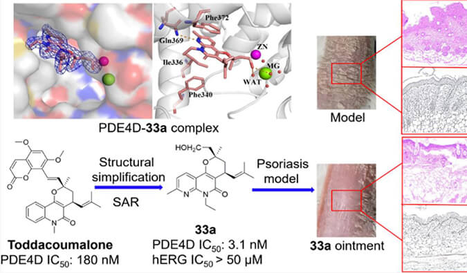 �������ھֲ�����ţƤѢ������PDE4���Ƽ�����������С�󡢴�����˸�΢����Ĵ�л�ȹ���ʵ��ͨ������÷�ⶨ