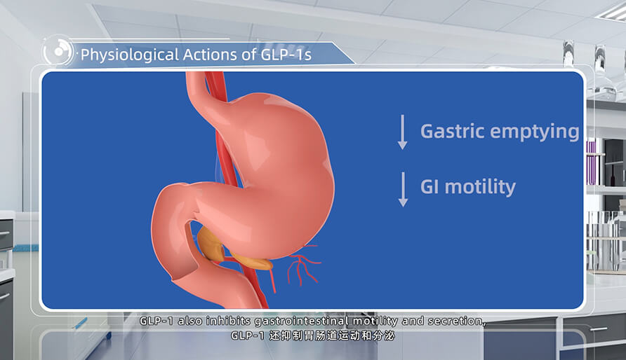 GLP-1s ������.jpg