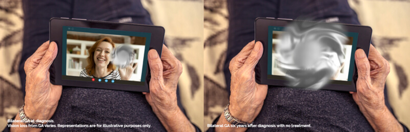 À©Õ¹ÑÛ¿ÆÁÆ·¨.jpg À©Õ¹ÑÛ¿ÆÁÆ·¨.jpg