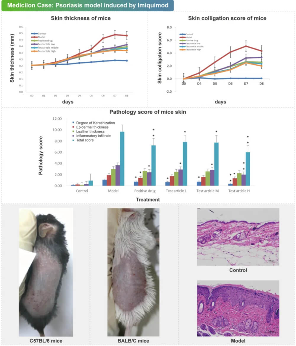 05 ���Ī���յ�����м��ģ��.jpg