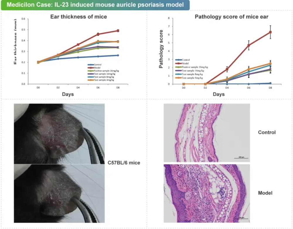 06 IL-23�յ���С�������м��ģ��.jpg